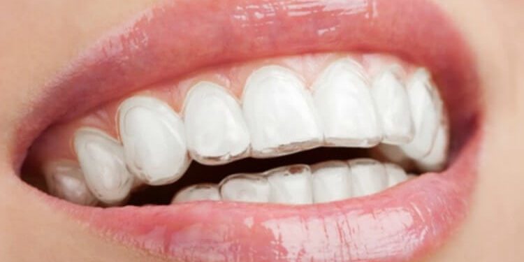 Causas maloclusión dental - Belén Pérez, dentista en Getxo