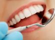 Con la odontología conservadora se busca reparar las piezas dentales y evitar su extracción