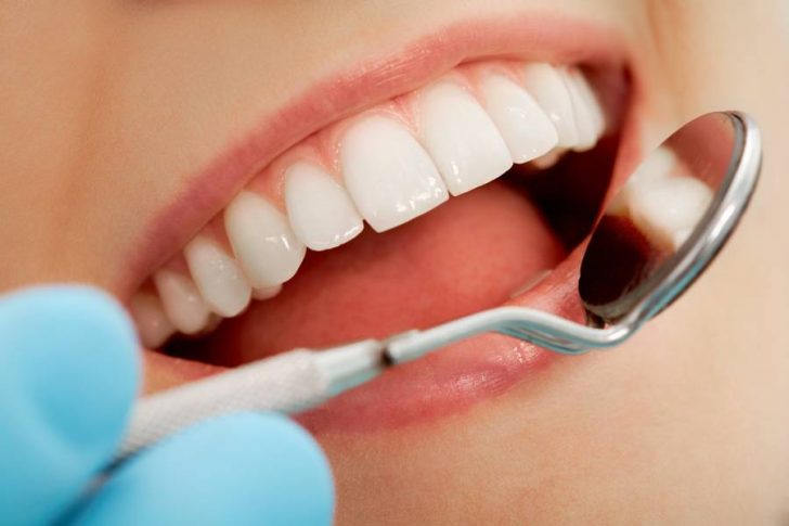 Con la odontología conservadora se busca reparar las piezas dentales y evitar su extracción