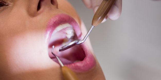 Dentista examinando la paciente tiene dientes con sarro