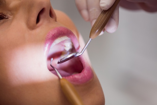 Dentista examinando la paciente tiene dientes con sarro