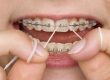 consejos cuidados con ortodoncia