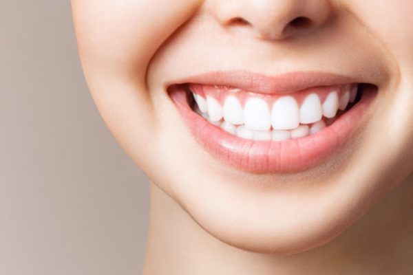 Como hacer un blanqueamiento dental casero - Clínica dental Belén Pérez