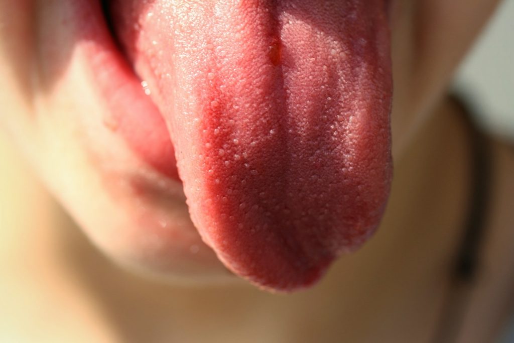 lengua salud dental