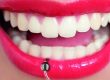 Piercings. ¿Qué daños provocan en tu boca?