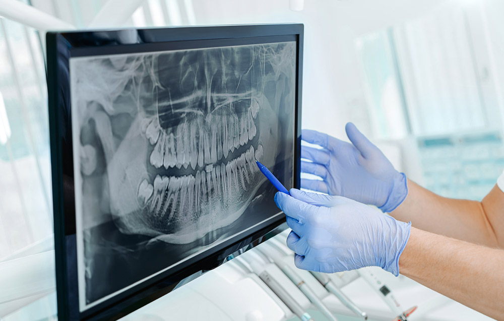 Diagnóstico de las enfermedades periodontales